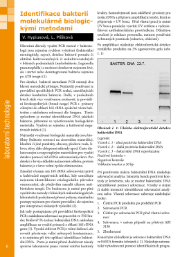 Identifikace bakteri&iacute; molekul&aacute;rně biologick&yacute;mi
