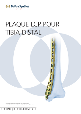 PLAQUE LCP POUR TIBIA DISTAL