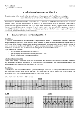 Electrocardiogramme