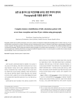 심한 골 흡수와 2급 악간관계를 보이는 완전 무치악 환자의