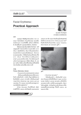 Facial Erythema : Practical Approach
