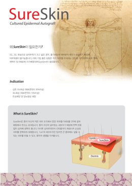 SURESKIN 카달로그
