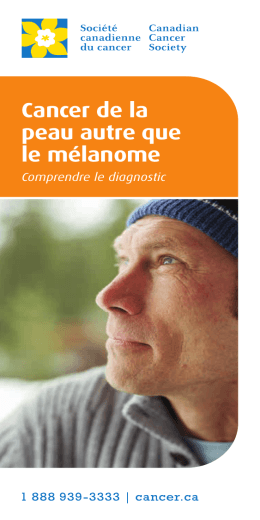Cancer de la peau autre que le m&eacute;lanome : Comprendre le diagnostic