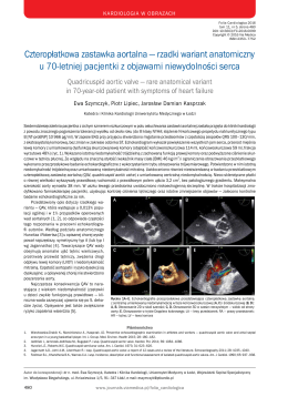 Czteropłatkowa zastawka aortalna — rzadki wariant anatomiczny u