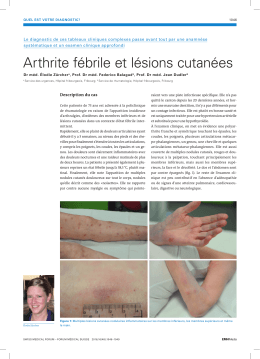 Arthrite f&eacute;brile et l&eacute;sions cutan&eacute;es