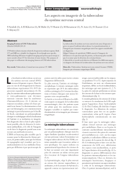 Les aspects en imagerie de la tuberculose du système nerveux