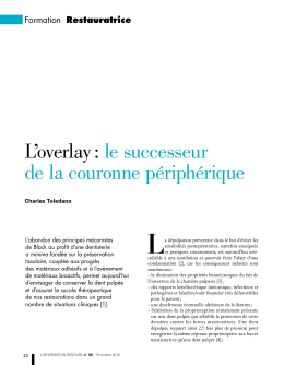 L`overlay : le successeur de la couronne p&eacute;riph&eacute;rique