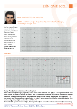 l`énigme ecg... - E