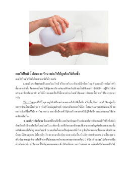 อ่านต่อ - Wacoal