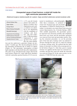 Renal sympathetic denervation assisted treatment of