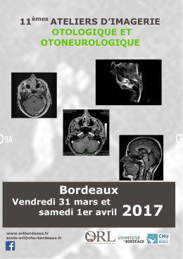 11&egrave;mes ateliers d`imagerie otologique et