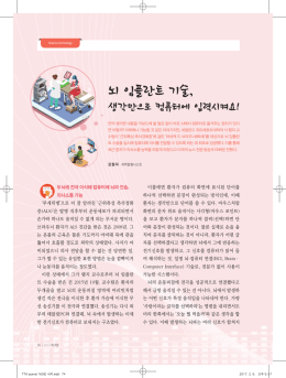 뇌 임플란트 기술,