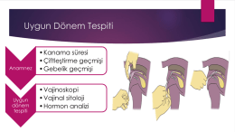 Uygun Dönem Tespiti