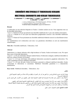 Article 11