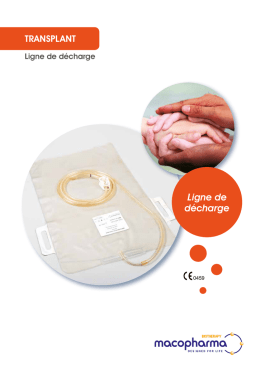 Ligne de d&eacute;charge